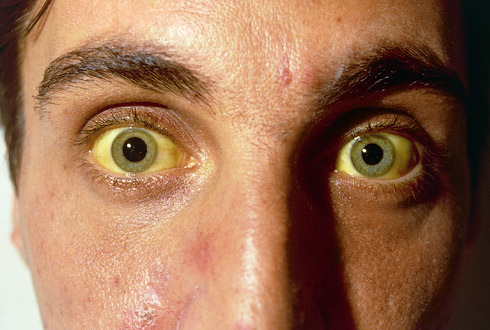 /data/blog/83173/b080523b1f0bd6efccc64b6bdb1401cf.jpg