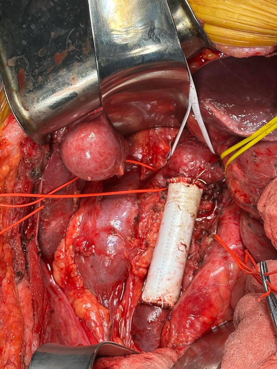 фото під час проведення операції